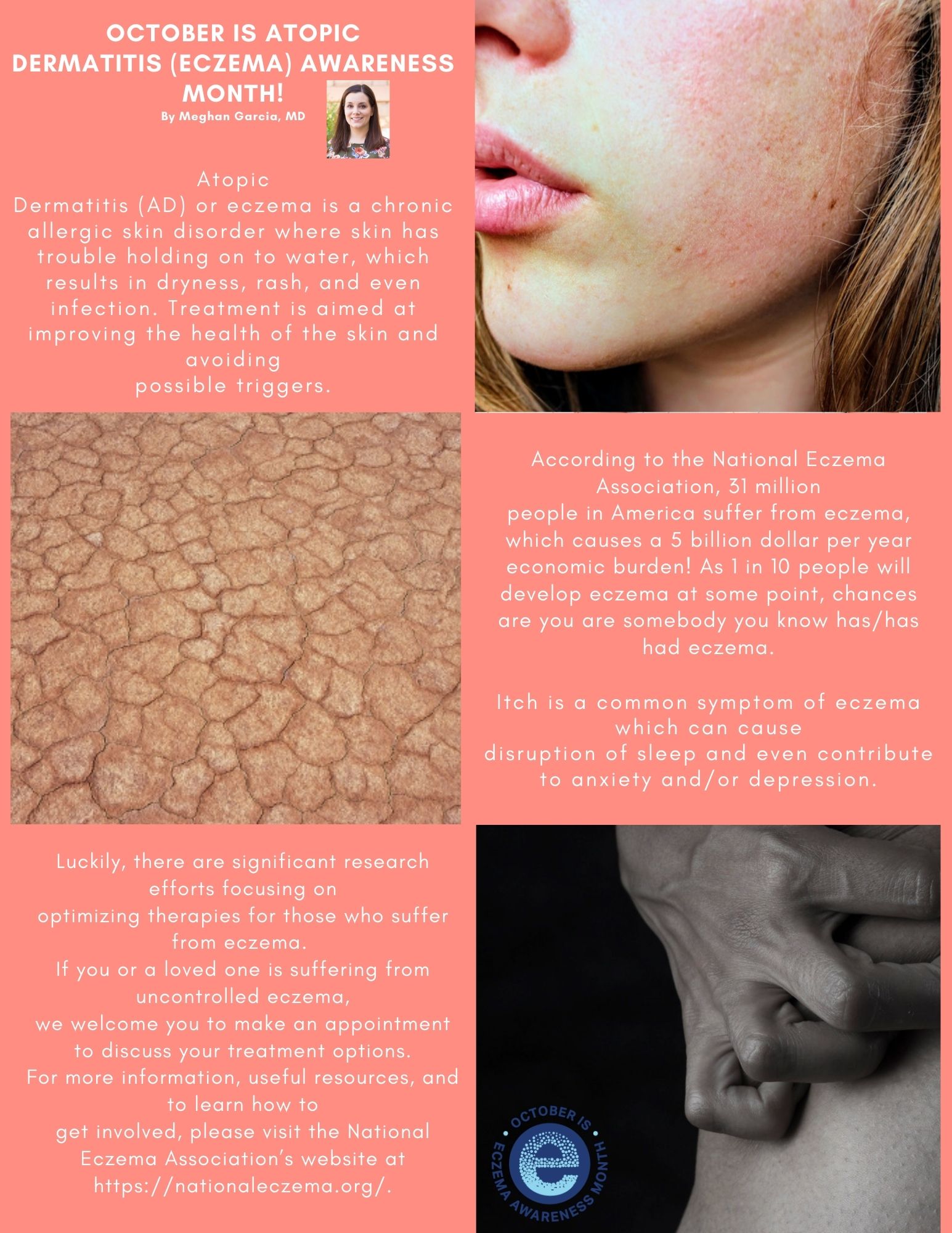 October Atopic Dermatitis (Eczema) Awareness Month Allergy Asthma